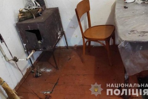 На Львівщині 2-річний хлопчик підпалив себе, граючись сірниками