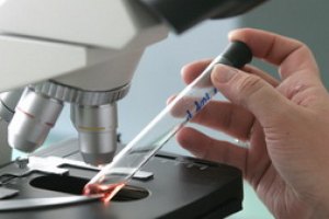 Обнаружен опасный вирус, способный передаваться от обезьян человеку