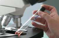 Обнаружен опасный вирус, способный передаваться от обезьян человеку