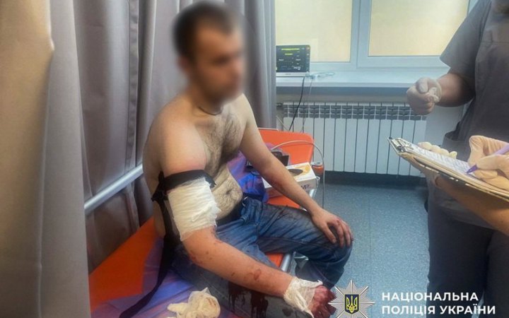​У Запоріжжі під час обшуку чоловік поранив ножем трьох поліцейських. Його застрелили