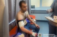 ​У Запоріжжі під час обшуку чоловік поранив ножем трьох поліцейських. Його застрелили