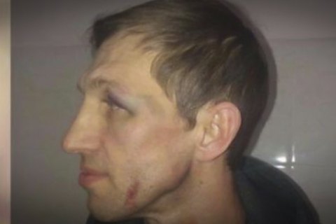 Учителя фізкультури, якого побив батько учня ліцею на Оболоні, виписали з лікарні