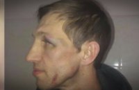 Учителя физкультуры, которого избил отец ученика лицея на Оболони, выписали из больницы