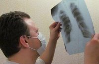 Рівень захворювання на туберкульоз серед дітей зріс до 1,5%