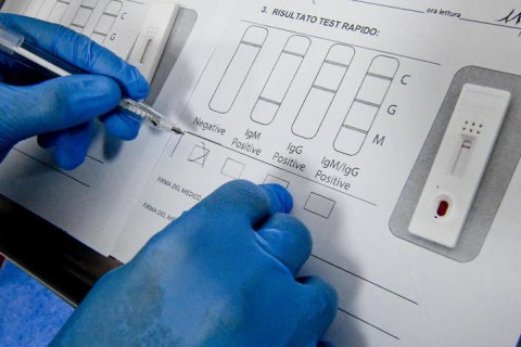 За сутки обнаружили 4 288 новых случаев ковида, 4 819 пациентов выздоровели, 68 - умерли