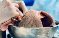 Хто активніший, той органів отримає більше: МОЗ пояснив, чому одні лікарні роблять більше пересадок за інших