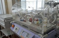 В Черновцах родились сиамские близнецы