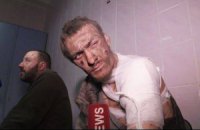 "Киборгу" с видео Life News нужна помощь