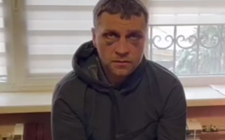 Тысяча наемников ЧВК «Вагнер» развернута на Востоке Украины, – британская разведка