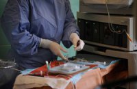 Одессит упал с четвертого этажа и остался жив
