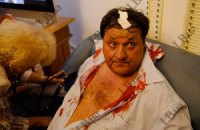 Пострадавшему во время драки бютовцу зашили голову 
