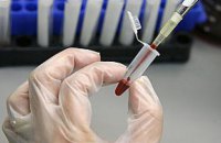 Россия готовится к эпидемии холеры в приграничных с Украиной областях, - украинская разведка