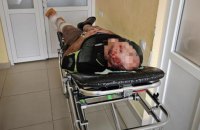 Чоловік зламав ногу при спробі втекти з України, вистрибнувши з поїзда