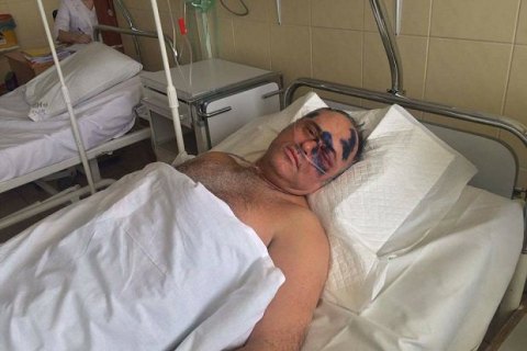 В Одессе избили главу райсовета (обновлено)
