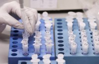 Майже 12% львів’ян мають антитіла до COVID-19
