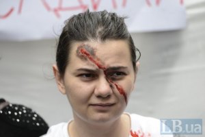 Правозащитники призвали Президента бороться с насилием