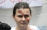 Правозащитники призвали Президента бороться с насилием