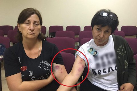 В Беслане напали на участниц акции против Путина