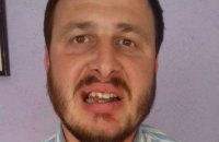 Священник УПЦ МП выбил зуб протоиерею УПЦ КП в Ровенской области
