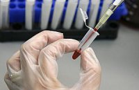 На Кубе почти 160 человек стали жертвами холеры