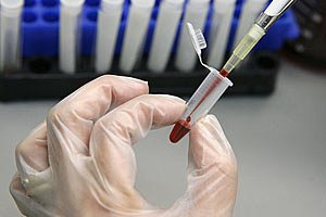 В Мариуполе обнаружили еще одного вибрионосителя холеры 