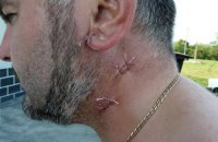 В Корсуне пьяный пономарь храма УПЦ МП нанес священнику УПЦ КП 8 ножевых ран