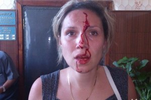 Крымский депутат избил семейную пару в своем кабинете