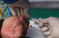 На Херсонщине СБУ разоблачила закупку некачественных COVID-тестов на 2 млн гривен