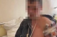 Судитимуть трьох військових РФ, які знущалися та закопували в холодний ґрунт мешканця Київщини, - ОГ