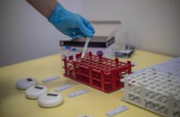 У світі зафіксували понад 100 млн випадків COVID-19