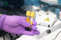 За сутки в Украине подтвердили более 5 тысяч новых случаев ковида