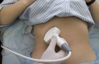 Украинские школьницы делают по 2 тысячи абортов в год
