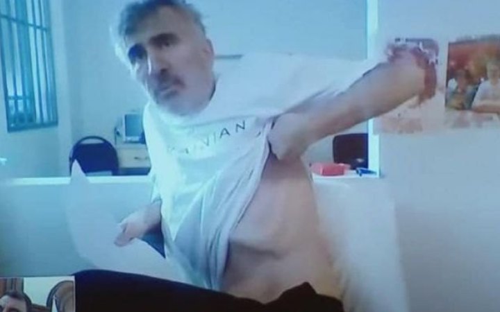 ​Польські лікарі отримали дозвіл провести огляд Саакашвілі