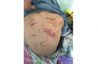 В Харькове арестовали двух мужчин за жестокое избиение 17-летнего парня