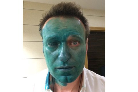 Навальный заявил о риске потерять зрение из-за химожога глаза