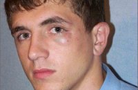 Возбуждено дело в связи с избиением кандидата от "УДАРа"