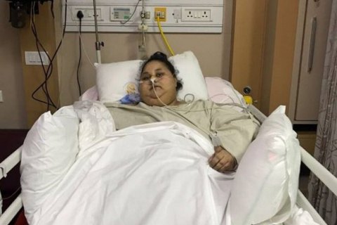 Найповнішу у світі жінку прооперували в Індії