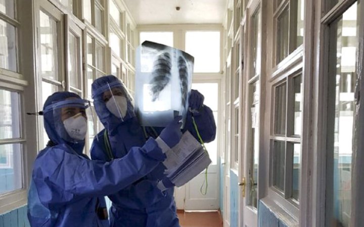 У Києві судитимуть керівника фірми, який присвоїв 13 млн на постачанні рентгенапаратів під час ковіду