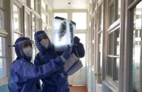 У Києві судитимуть керівника фірми, який присвоїв 13 млн на постачанні рентгенапаратів під час ковіду