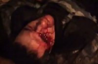 Сотрудник "Беркута" потерял глаз