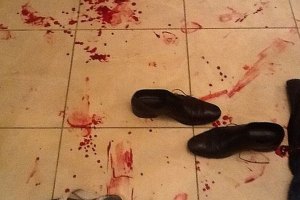 Милиция завела дело в связи с нападением на помощника Андриевского