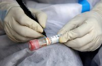 В Україні зафіксовано новий рекорд кількості тих, хто одужав від COVID-19