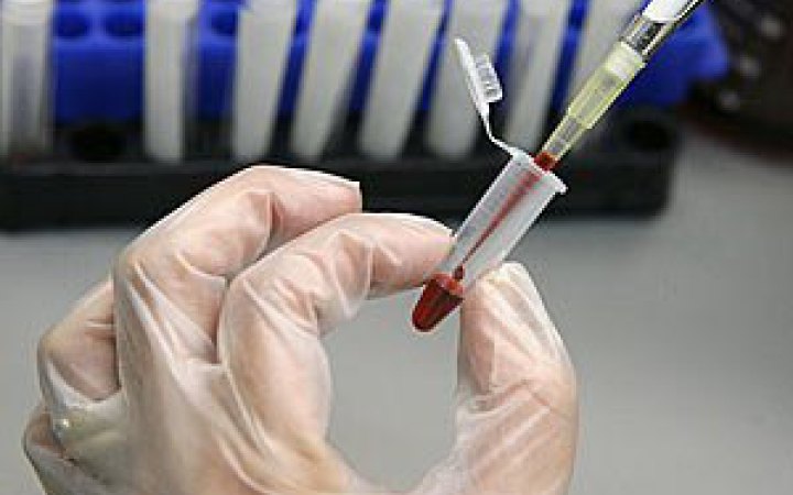 Випадків холери в Україні не зафіксовано, - Ігор Кузін