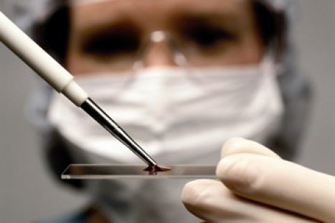 Экс-руководителя Запорожского облцентра службы крови подозревают в продаже 270 литров плазмы