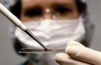 Экс-руководителя Запорожского облцентра службы крови подозревают в продаже 270 литров плазмы