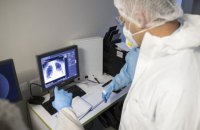 У Києві за добу від ковіду померли 30 людей, 512 одужали