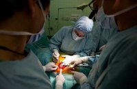 В Индии хирурги извлекли более 600 гвоздей из желудка пациента