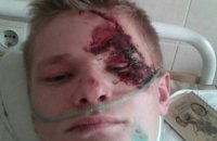 Випускнику школи-інтернату потрібна допомога на лікування і відновлення