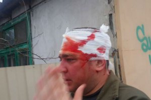 В Одессе милиция возбудила уголовное дело по факту драки