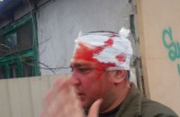 В Одессе милиция возбудила уголовное дело по факту драки